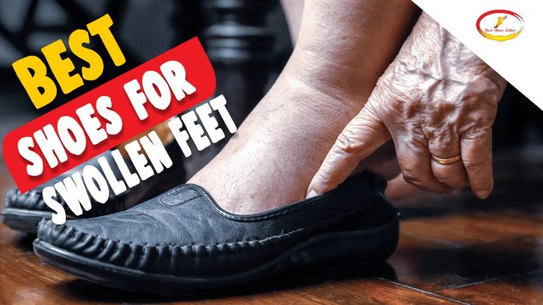 What is The Best Shoes For Swollen Feet